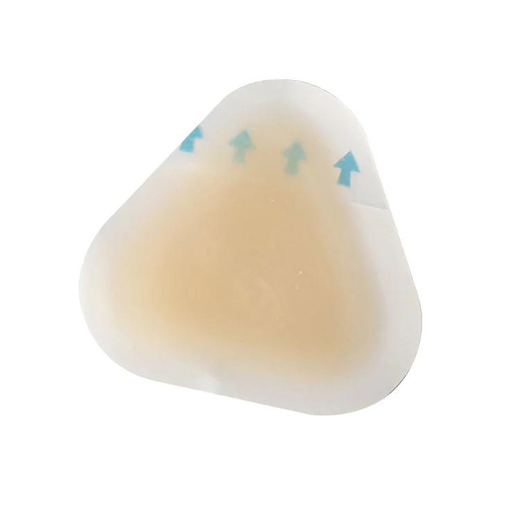 Sterili kulnų pūslelių prevencija: kaip apsaugoti kojas nuo skausmo, infekcijų ir trinties pažeidimų