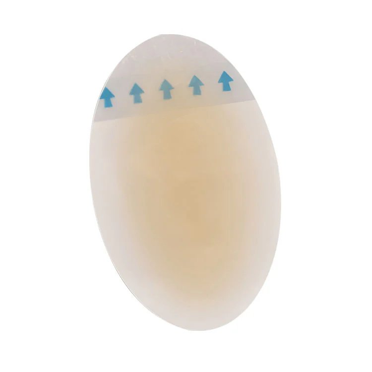 Kaip vandeniui atsparios pūslelinės juostelės pėdoms ir pirštams apsaugo jūsų odą vaikščiojant, žygiuojant ir sportuojant